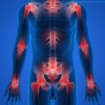 Arthrose et ostéopathie : mieux vivre avec la mobilité